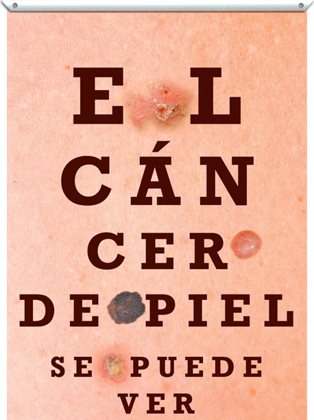 El cancer se puede ver