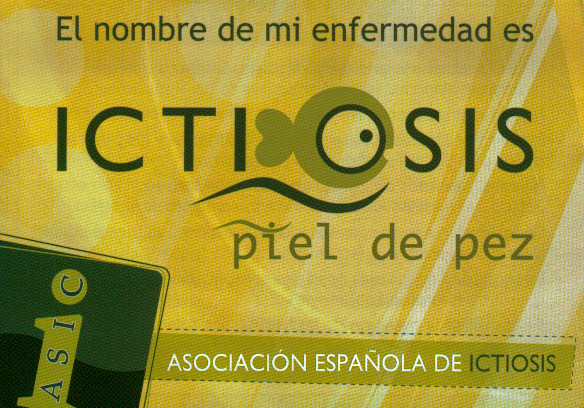 Piel de pez Ictiosis